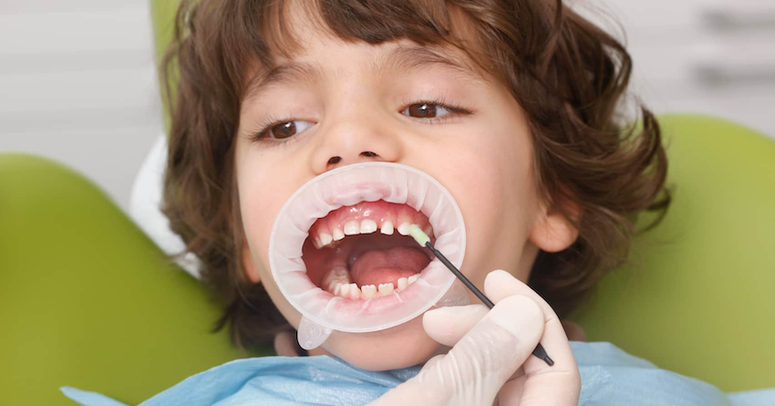 Giải đáp đáp án Câu hỏi 1 cho bài đọc "More Cavities Needed"